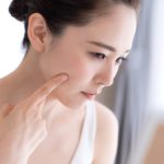 ニキビに悩む女性