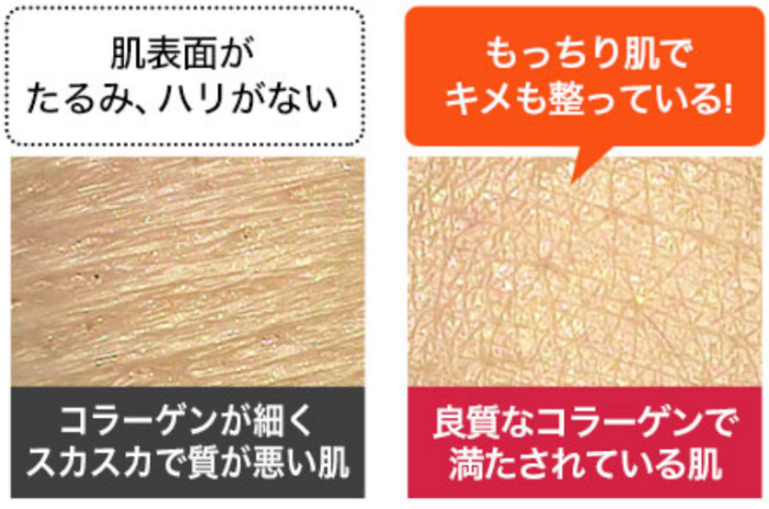 ファンケルの化粧液の特徴